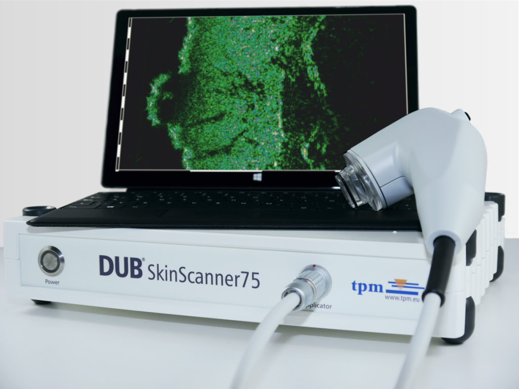DUB SkinScanner75 with tablet